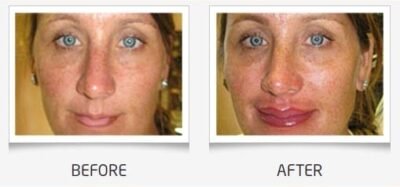 Before and after permanent makeup Dallas BrowLady