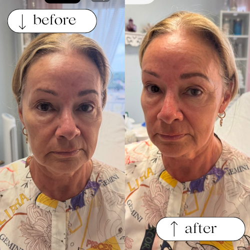 permanent-eyebrows-services-in-dallas