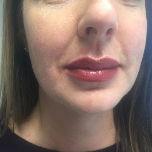 Permanent lip liner and lip blush Dallas by Silvia Young