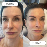Permanent Eyebrows Services in Dallas