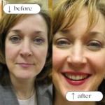 Permanent Eyebrows Services in Dallas