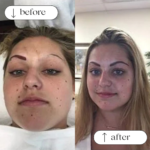 Permanent Eyebrows Services in Dallas