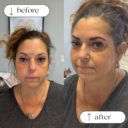 Permanent Eyebrows Services in Dallas