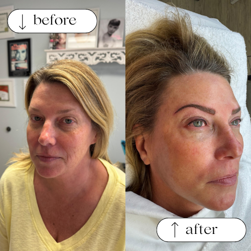Permanent Eyebrows Services in Dallas