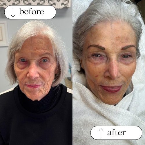 Permanent Eyebrows Services in Dallas