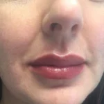 Permanent Lip Blushing in Dallas