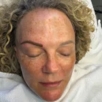 Permanent Microblading in Dallas