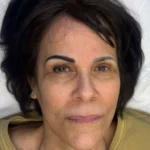 Permanent Eyebrows in Dallas