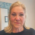 Permanent Eyebrows in Dallas