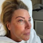 Permanent Microblading in Dallas