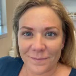Permanent Microblading in Dallas