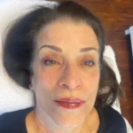 Permanent Lip Blushing in Dallas
