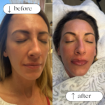 Permanent Lip Blushing in Dallas