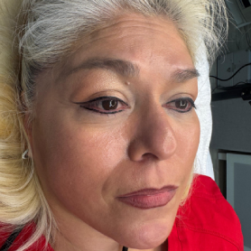 Permanent Eyeliner in Dallas